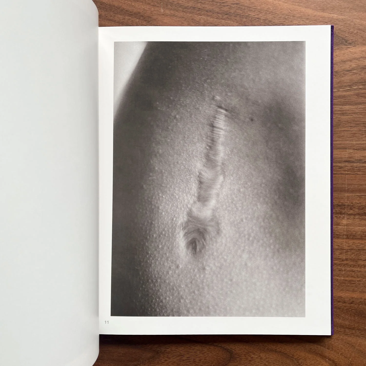 Scars by Miyako Ishiuchi - Image 2