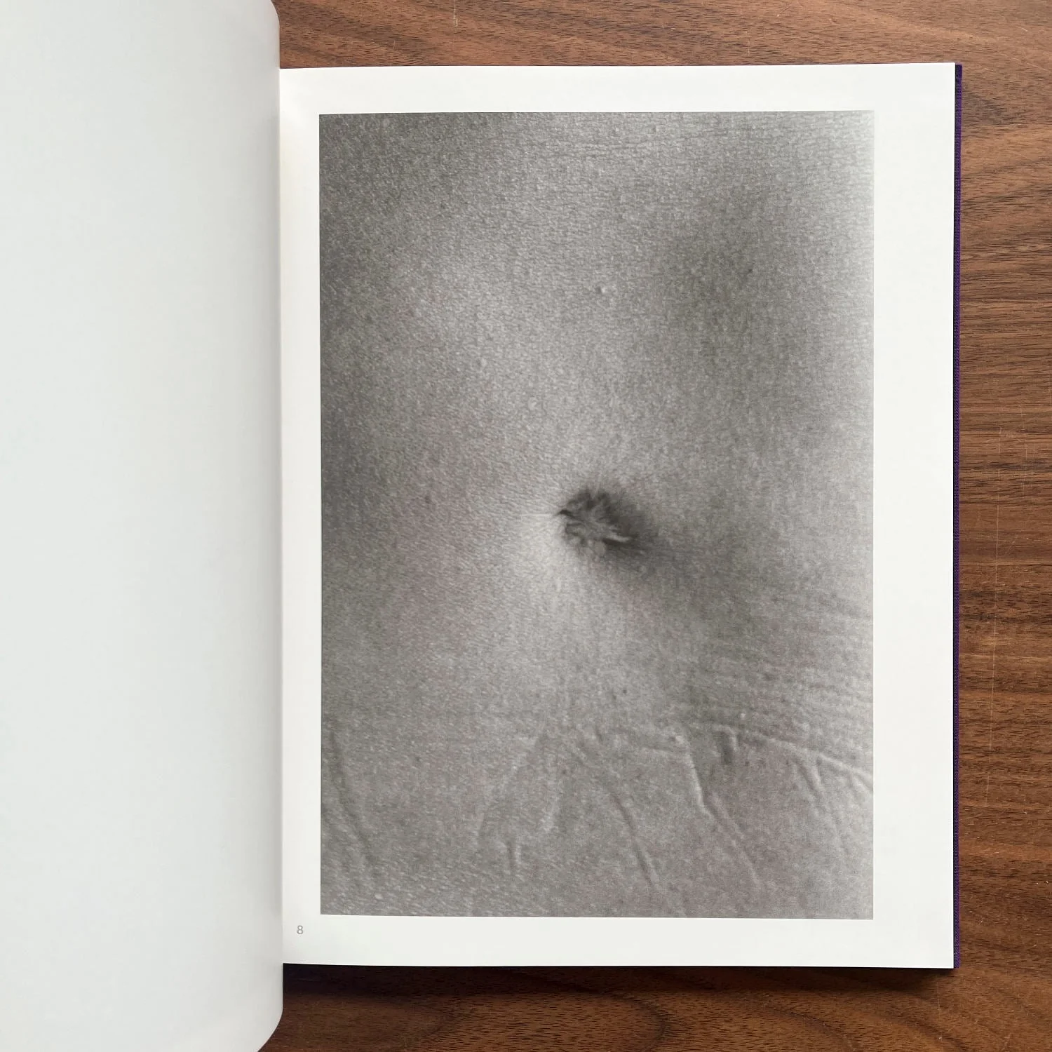 Scars by Miyako Ishiuchi - Image 3