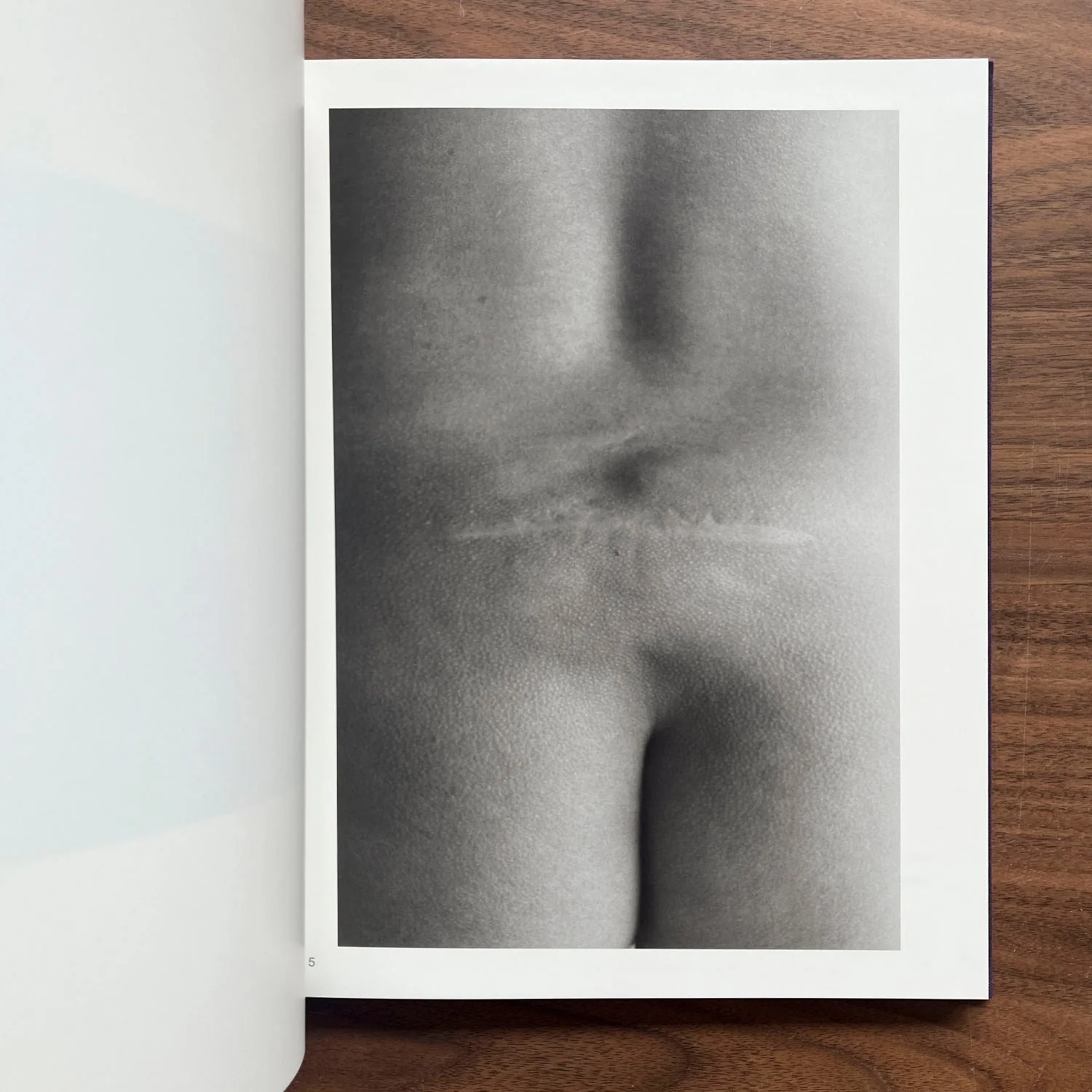 Scars by Miyako Ishiuchi - Image 4