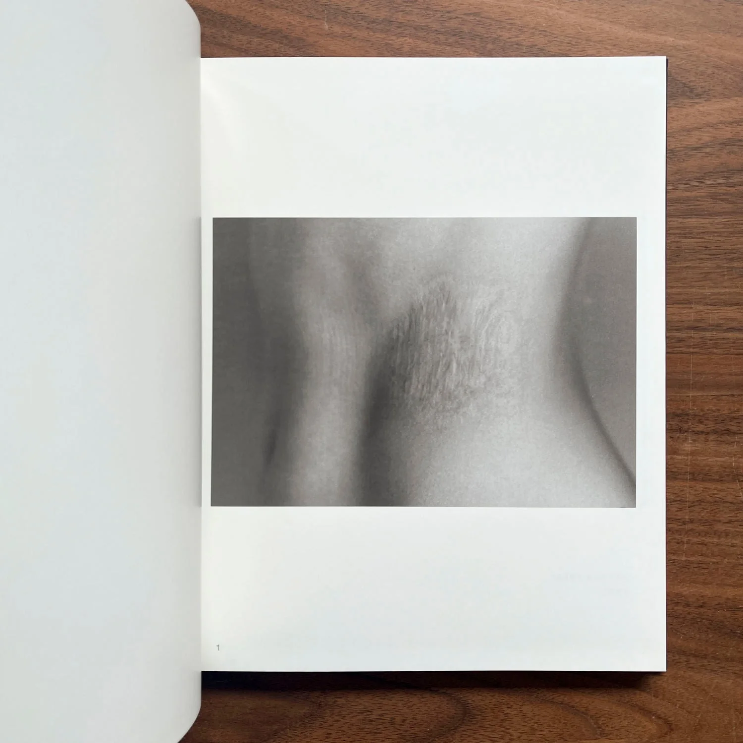 Scars by Miyako Ishiuchi - Image 5