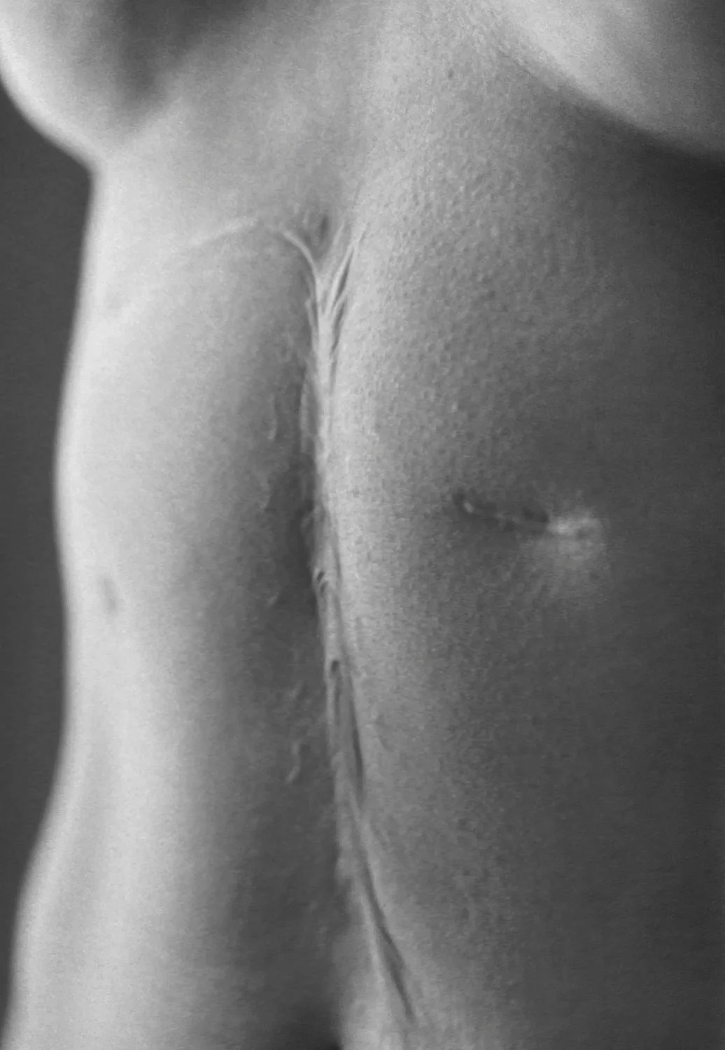 Scars by Miyako Ishiuchi - Image 6
