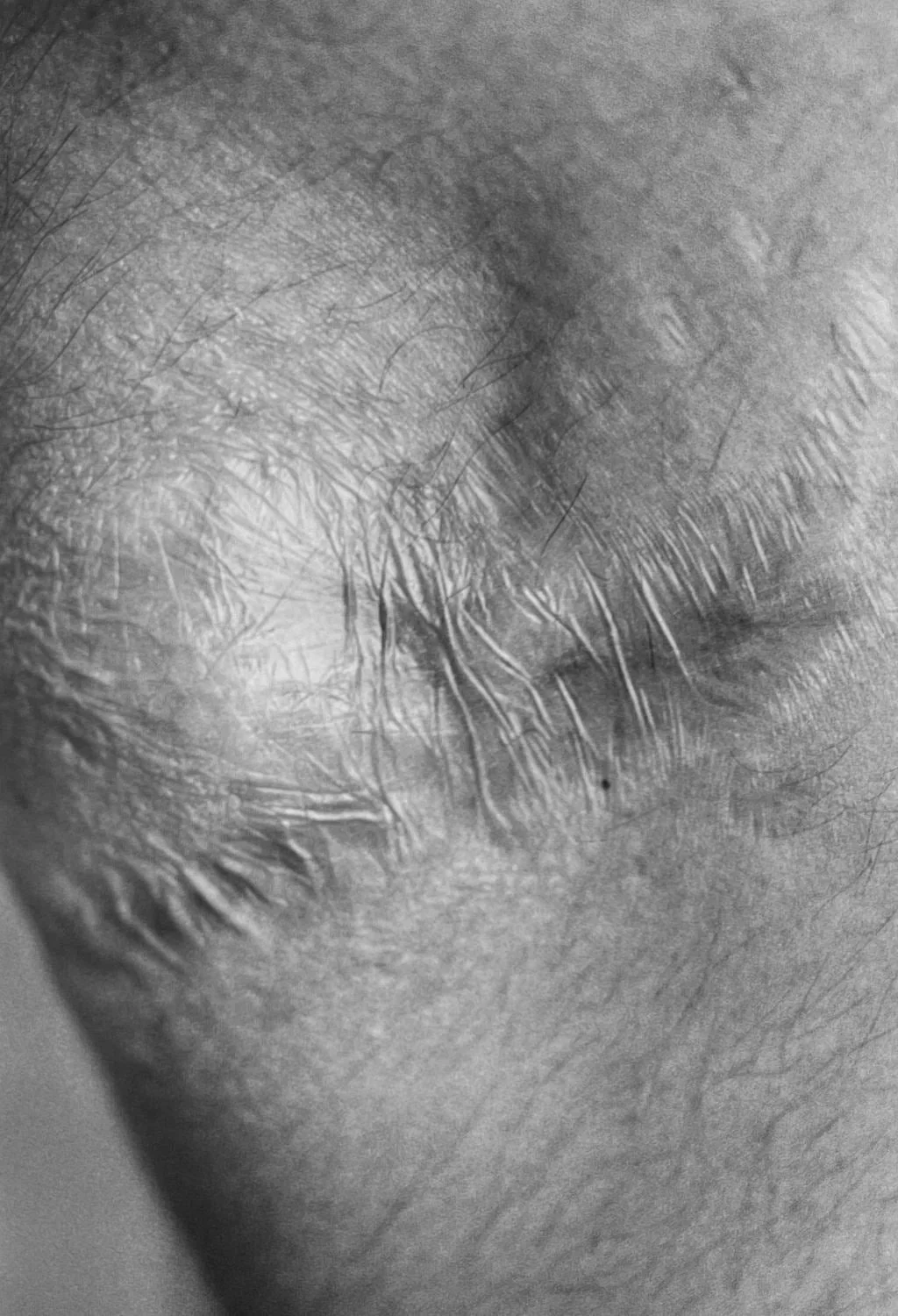Scars by Miyako Ishiuchi - Image 7
