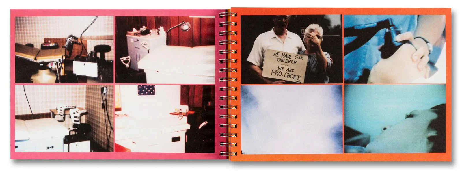 The Last Safe Abortion by Carmen Winant - Image 2